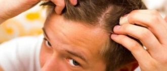 Выпадение волос у подростка