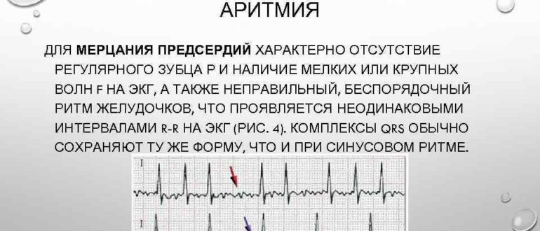 Мерцательная аритмия: пароксизмальная форма фибриляции предсердий-Эгилок или Беталок Зок?