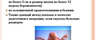 Миома матки малых размеров