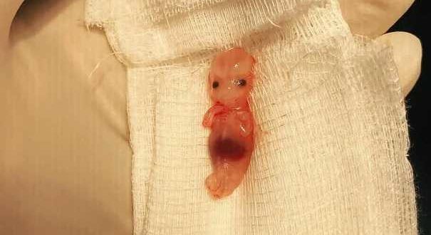 Выделения на 9 неделе беременности