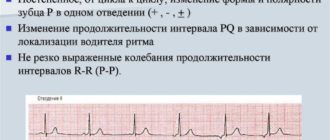 Миграция водителя ритма