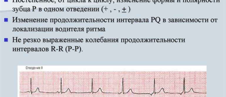 Миграция водителя ритма