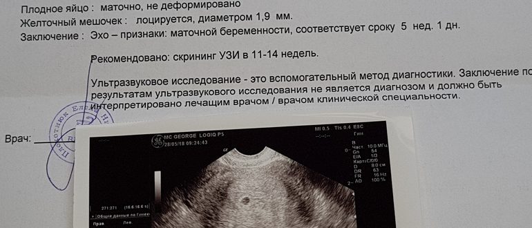 На каком сроке задержки врач может увидеть беременность на осмотре?