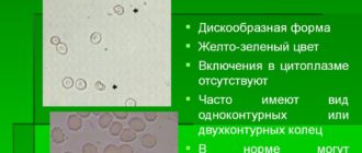 Высокая температура и эритроциты в моче