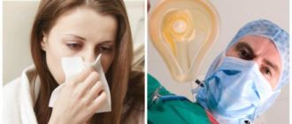 Наркоз при простуде
