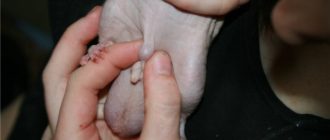 Воспаление писюна