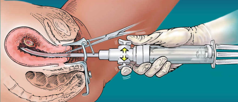 Может ли быть такое или нет?