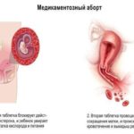 Кошачьи царапины, аллергия или норма?