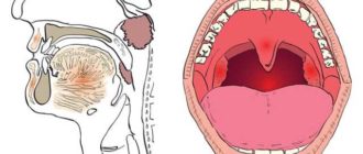 Чувство удушья в горле после удаления зуба