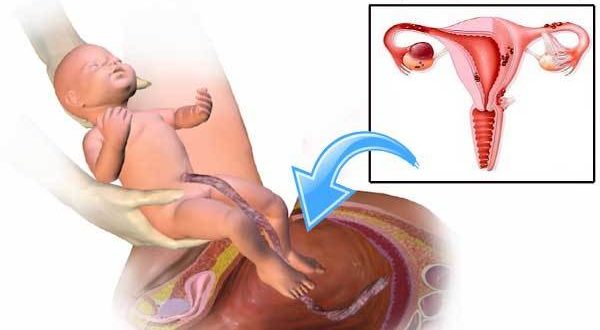 Возможна ли беременность спустя месяц