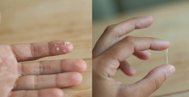 Выделения с запахом хлеба