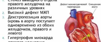 ВПР ВПС Тетрадо Фало