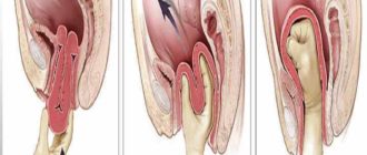 Что-то выходит из влагалища после родов