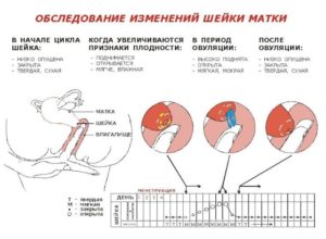 Мучает боль во время овуляции