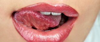 Вязкая слюна с горячим дыханием и отекшим языком