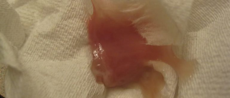 Выделения при беременности после осмотра на кресле