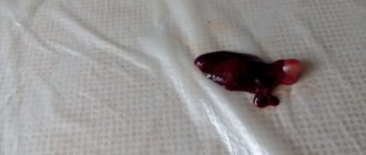 Мешочек со льдом после аборта