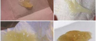 На 15 день цикла появилась жёлтая слизь