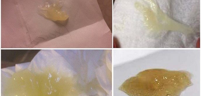 На 15 день цикла появилась жёлтая слизь