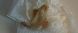 Выкидыш, розовые выделения