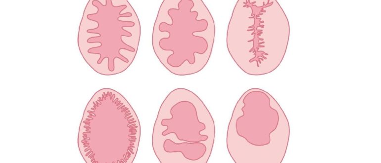 Может ли зарасти девственная плева?