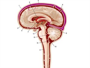 Дилатация ликворной системы головного мозга и субархидаидального пространства