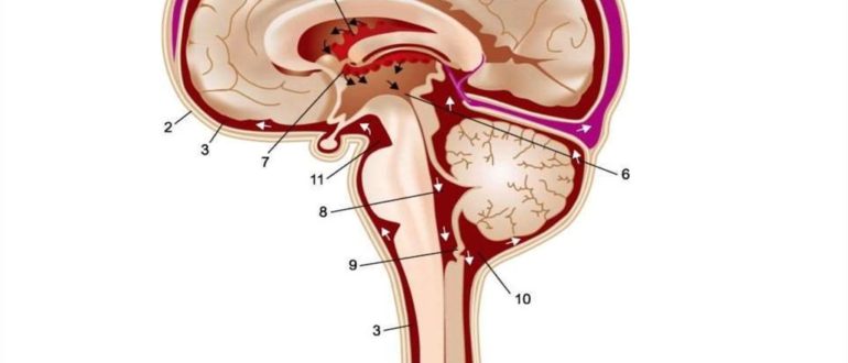 Признаки церебральной венозной дисциркуляции