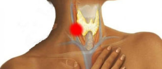 Дискомфорт в горле - распирание, режущая боль при пустом глотке