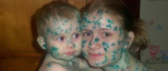 Мог ли ребенок чем-то заразиться?