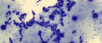 Мицелий гриба в мазке. НЕ КАНДИДА