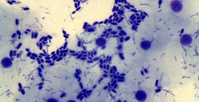 Мицелий гриба в мазке. НЕ КАНДИДА