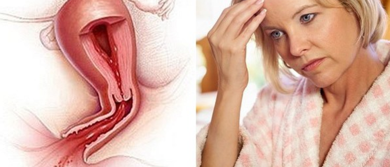 Месячные и климакс