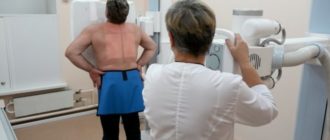Можно ли делать рентген грудного отдела позвоночника при мастопатии?