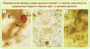 Дрожжевые грибы и йодофильная флора в кале у грудничка