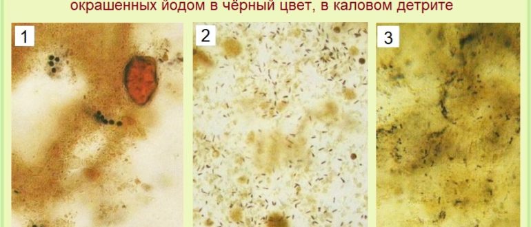 Дрожжевые грибы и йодофильная флора в кале у грудничка