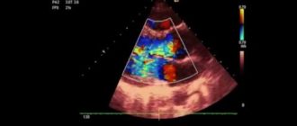 ВПС: ДАК с НАК 1 ст