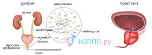 Микоплазма и простатит