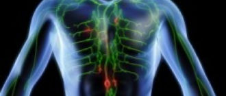 Внутрисосудистая лимфома