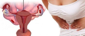 Месячные во время лечения Диферелином