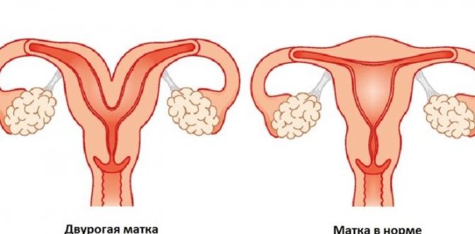 Двурогая матка беременность вторая коричневые выделения беспокоят часто