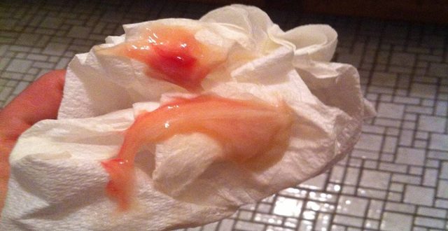 Месячные не вытекают