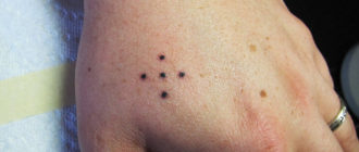 Черная точка на тату