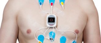 Мониторинг сердечно ритма