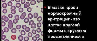 Эритроциты в мазке