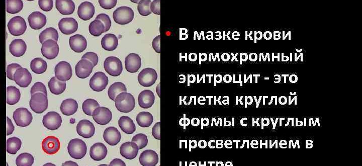 Эритроциты в мазке. Эритроциты в мазке у женщин. Мазок на флору эритроциты. Эритроциты в мазках у женщин. Эритроциты в мазке на флору у женщин.