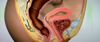 Дискомфорт внутри влагалища.