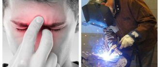 Нахватался зайчиков от сварки