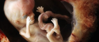 Может ли малыш замёрзнуть в утробе?