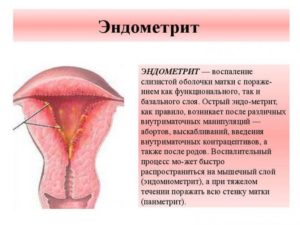 Эндометрий после родов