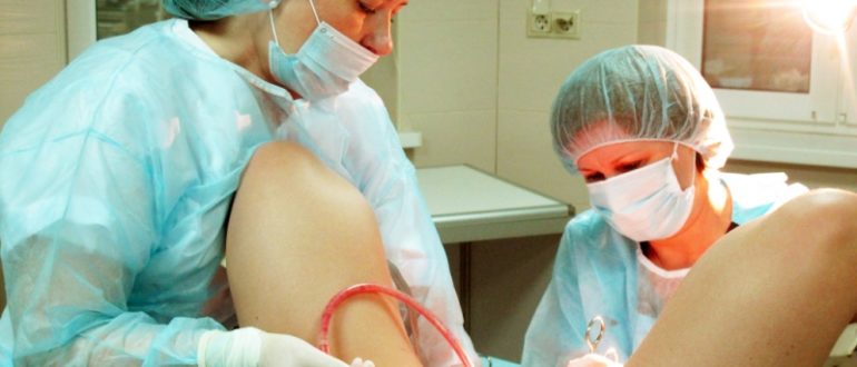 Месячные после диагностического выскабливания